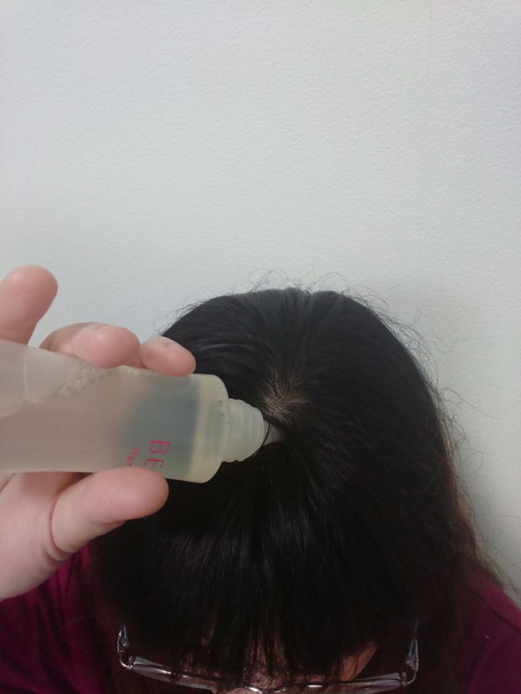 ベルタ ヘアローション/BELTA(ベルタ)/頭皮ローションを使ったクチコミ(5枚目)