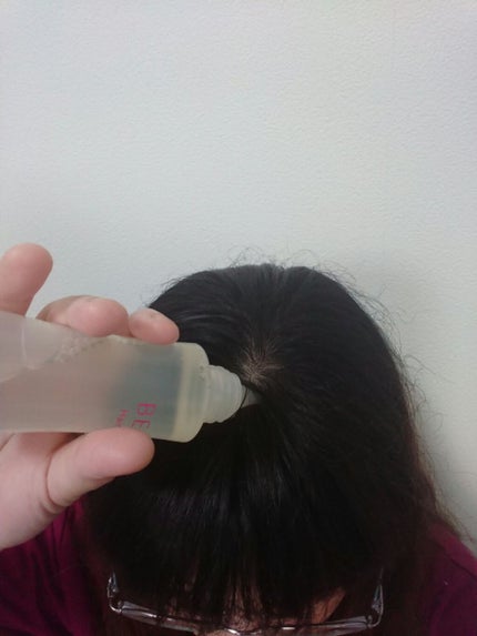 ベルタ ヘアローション/BELTA(ベルタ)/頭皮ローションを使ったクチコミ(5枚目)