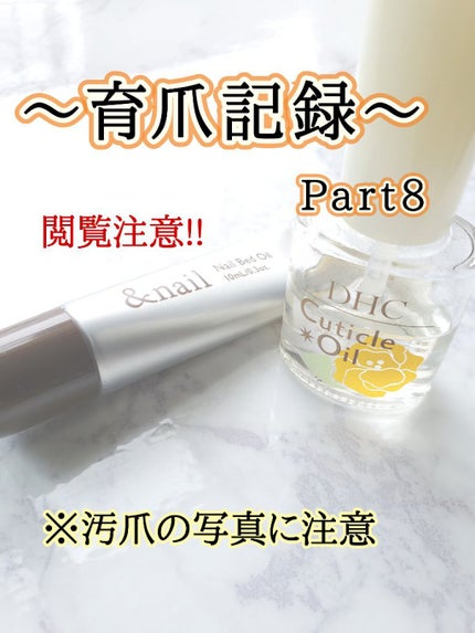 ネイルベッドオイル/アンドネイル/ネイルオイル・トリートメントを使ったクチコミ(1枚目)