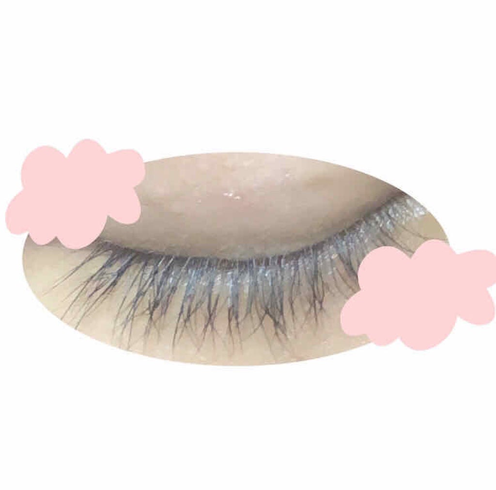 はなび on LIPS 「お久しぶりです💦遅くなりました🙇♀️埋没してから二ヶ月程経ち..」(2枚目)