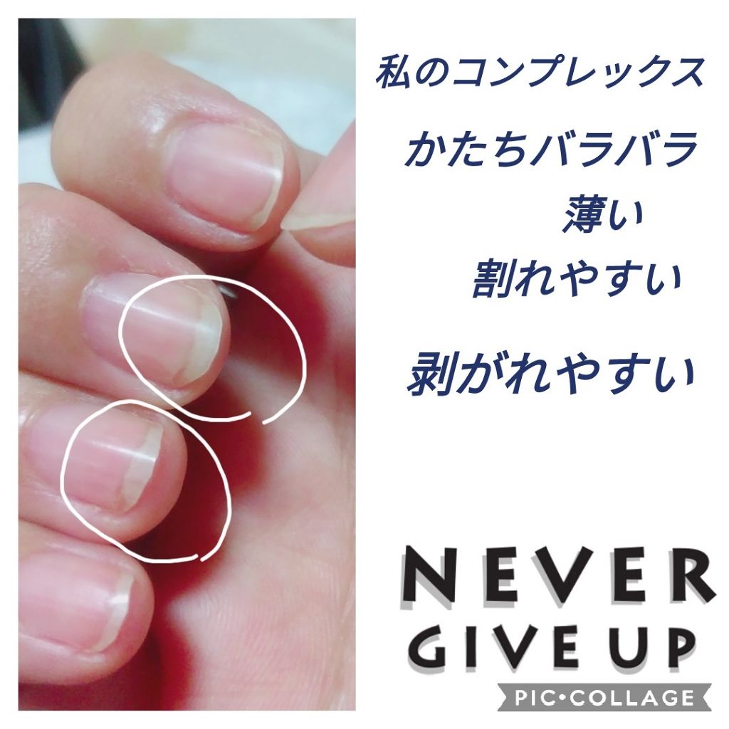 キューティクルオイル/ネイルホリック/ネイルオイル・トリートメントを使ったクチコミ（2枚目）