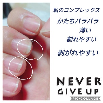 キューティクルオイル/ネイルホリック/ネイルオイル・トリートメントを使ったクチコミ(2枚目)