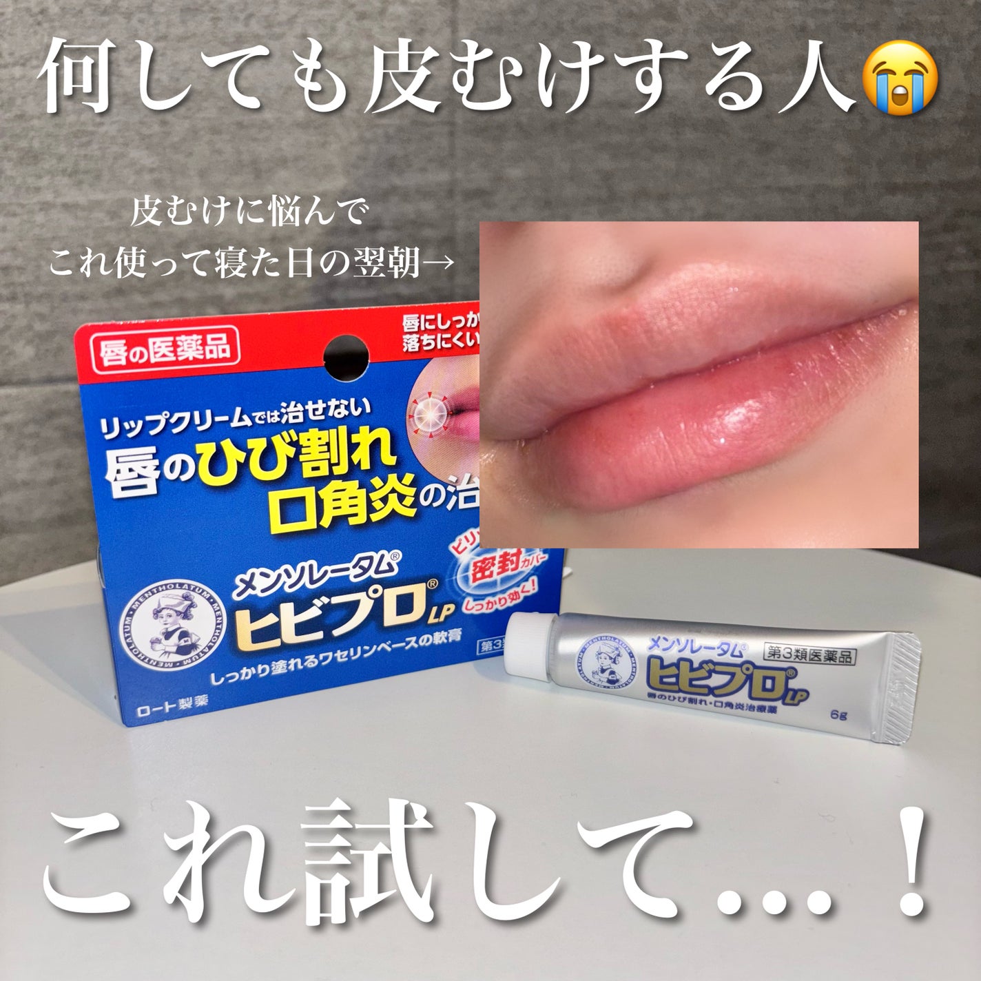 ヒビプロLP(医薬品)/メンソレータム/その他を使ったクチコミ(1枚目)