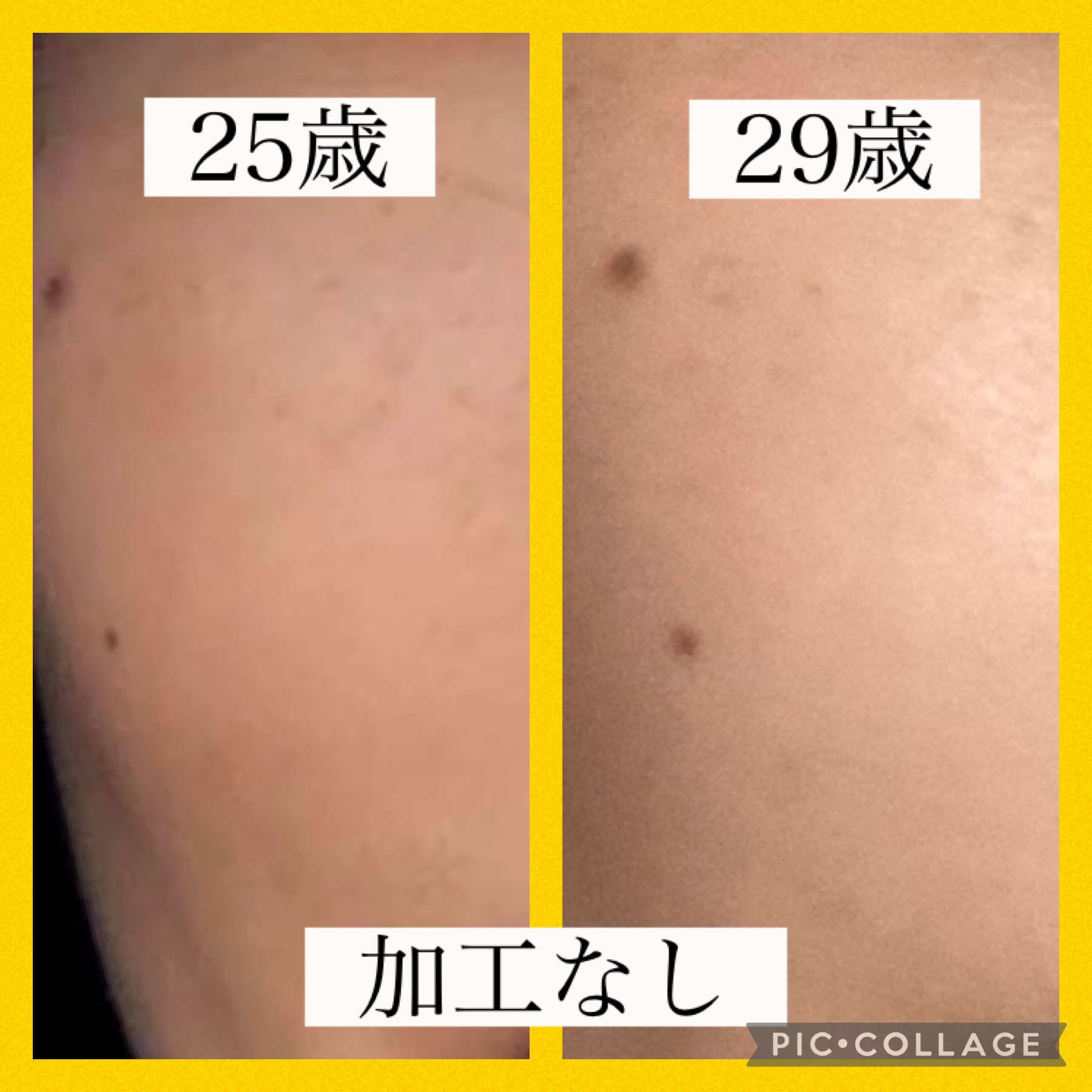 薬用しみ集中対策 プレミアム美容液/メラノCC/美容液を使ったクチコミ（2枚目）