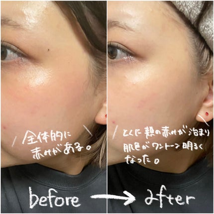 ブライトピュアパック/CandyDoll/洗い流すパック・マスクを使ったクチコミ(4枚目)