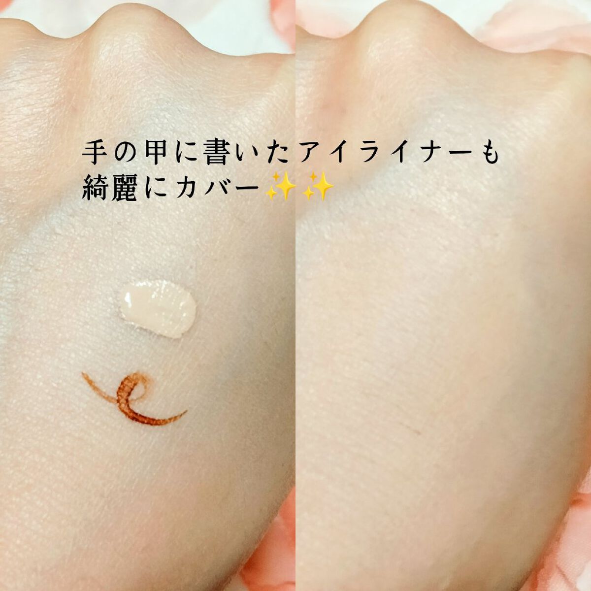 タトゥーウォータープルーフスカーコンシーラー/フォレンコス/リキッドコンシーラーを使ったクチコミ（3枚目）