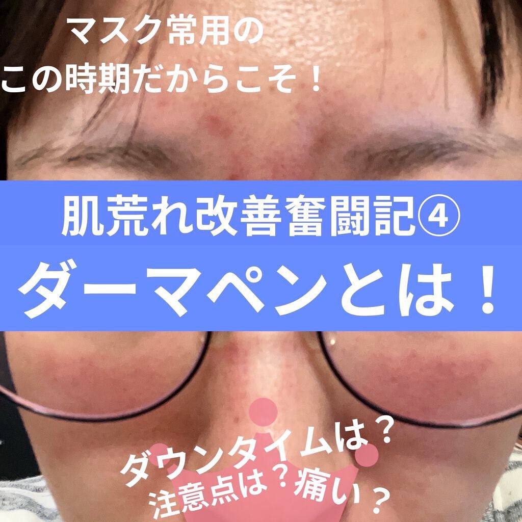 シロミ on LIPS 「【肌荒れ改善奮闘記④】前回から大分間が空きましたが、皮膚科へ行..」(1枚目)