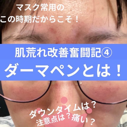 を使ったクチコミ(1枚目)