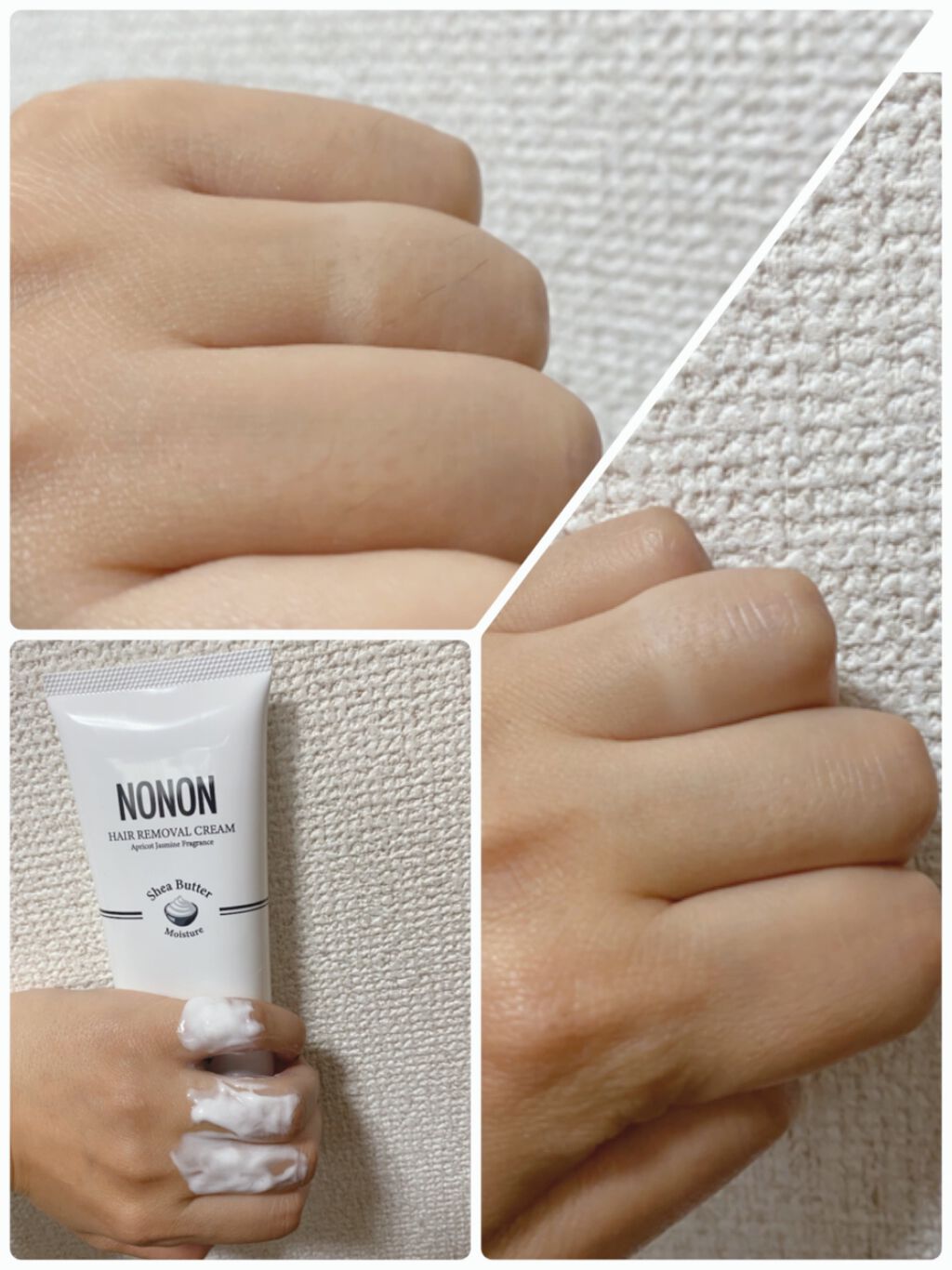 NONON/NONON(ノンノン)/除毛クリームを使ったクチコミ（2枚目）
