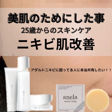 IHADA イハダ 薬用バーム【医薬部外品】のクチコミ「❗️ニキビ肌の人必見❗️

.

干物ちゃんです🐟

.

今日は私がニキビ肌中に
愛用してい.....」（1枚目）