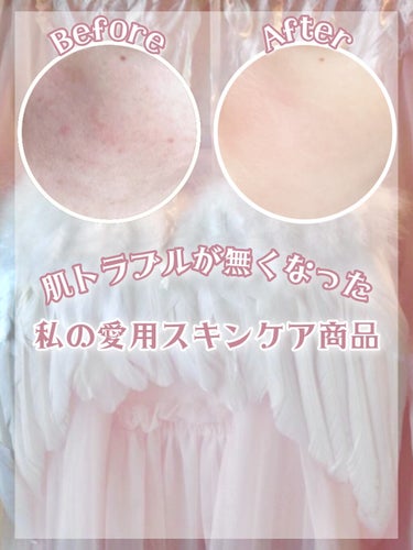 乳液・敏感肌用・しっとりタイプ/無印良品/乳液を使ったクチコミ（1枚目）