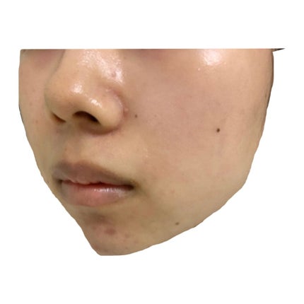 白色ワセリン(医薬品)/健栄製薬/その他を使ったクチコミ(3枚目)