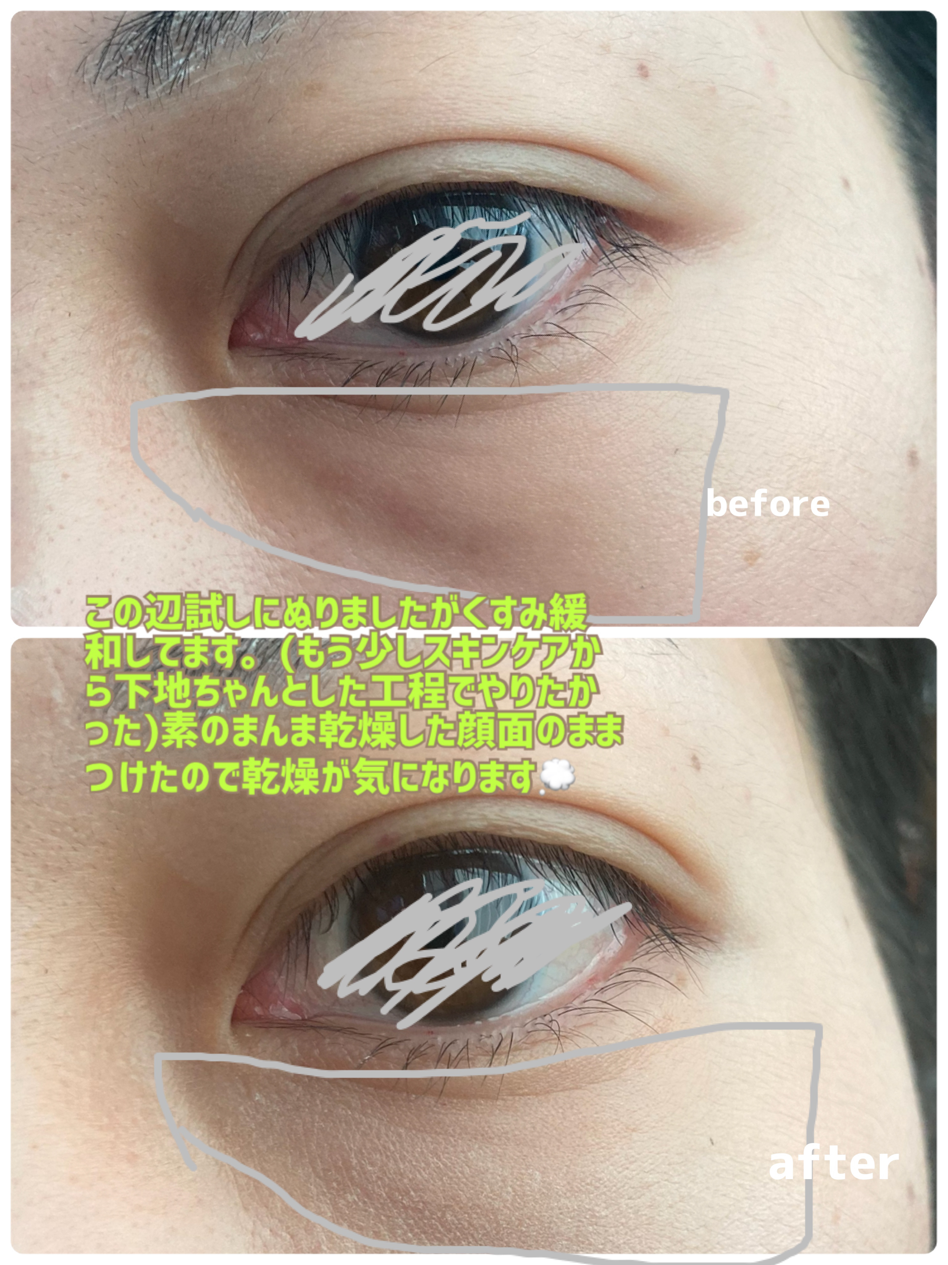 ５カラーコンシーラーパレット/Kirei&amp;co./パレットコンシーラーを使ったクチコミ（3枚目）