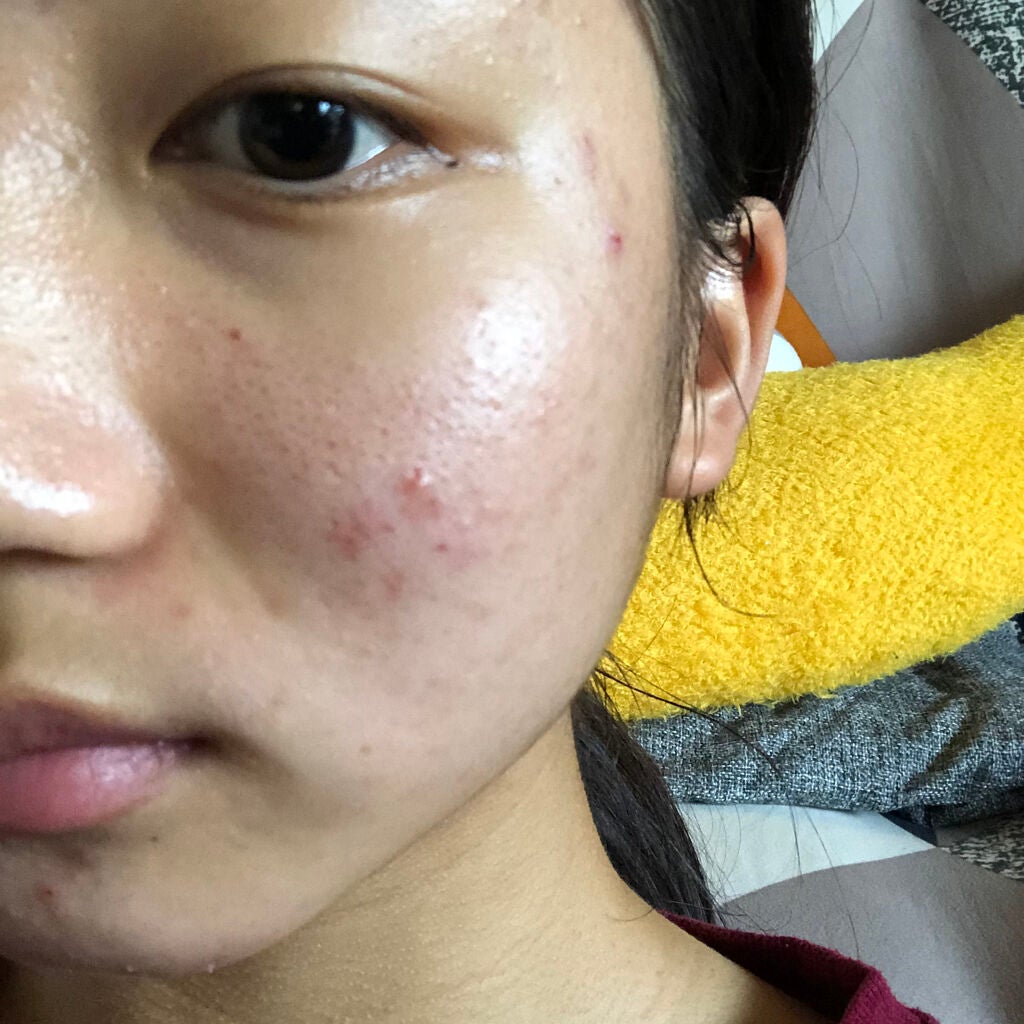 ディープモイスチャースプレー/キュレル/ミスト状化粧水を使ったクチコミ(1枚目)