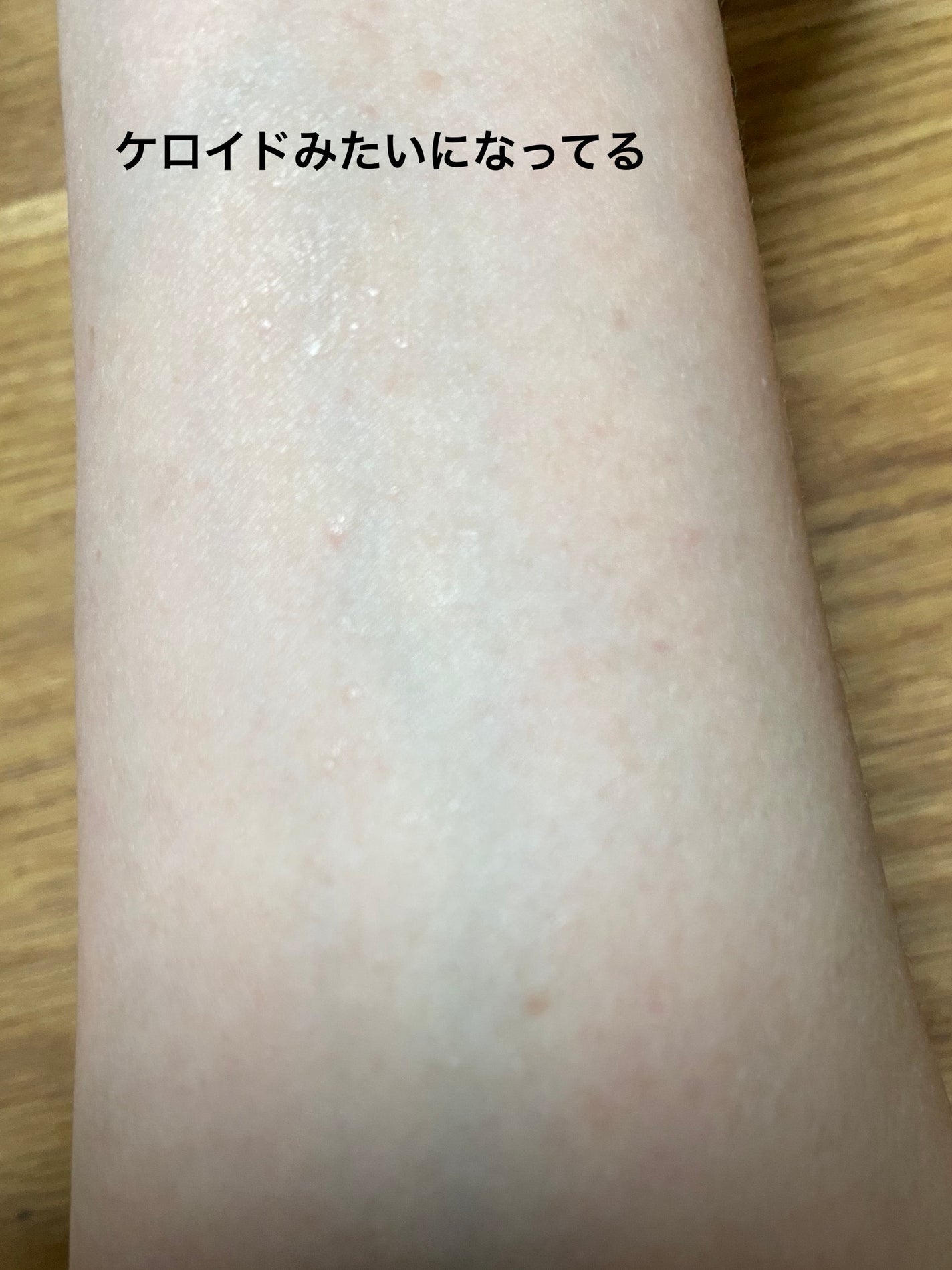 リードルショット100/VT/美容液を使ったクチコミ(3枚目)