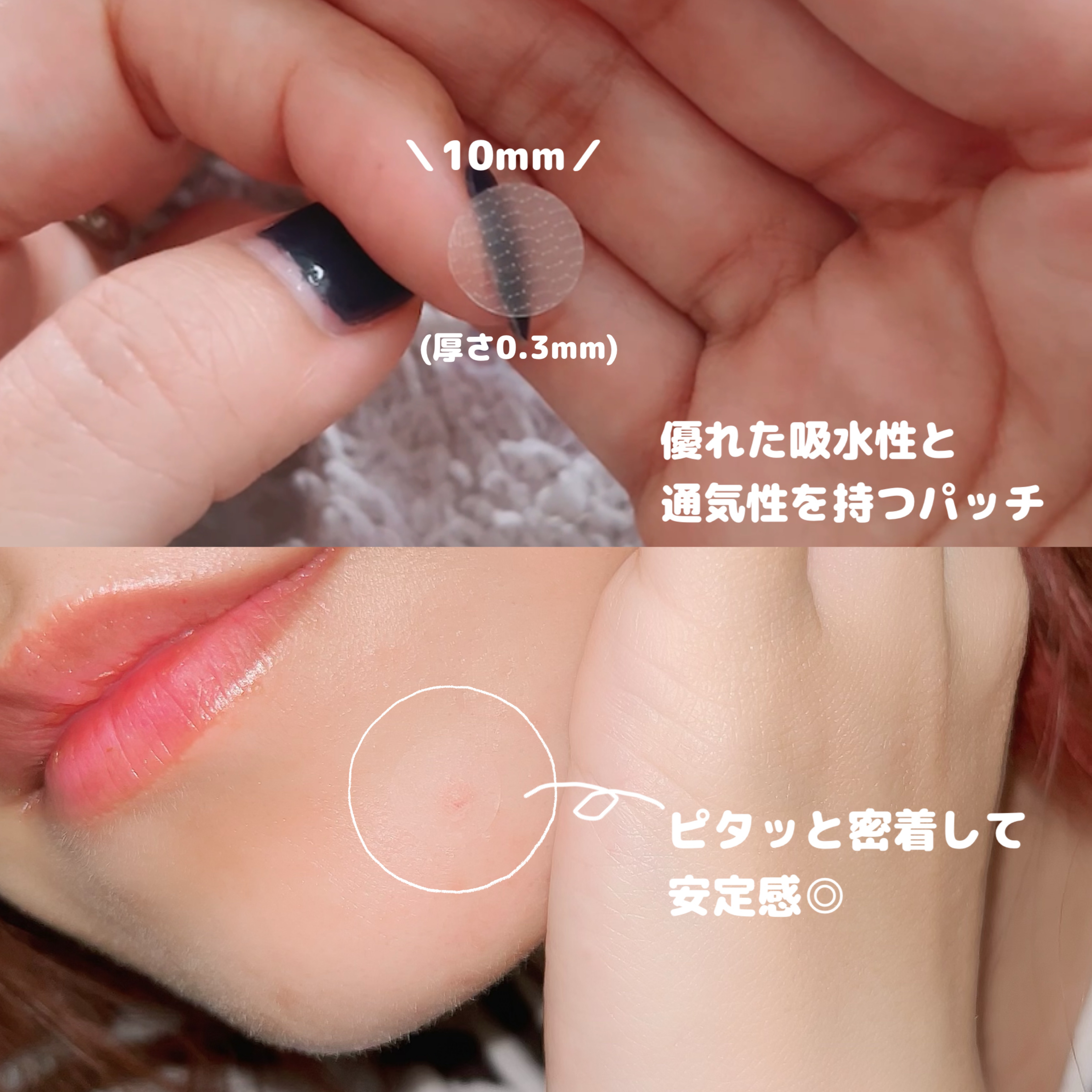 SPOT PATCH ロールタイプ/Shupong/にきびパッチを使ったクチコミ（3枚目）