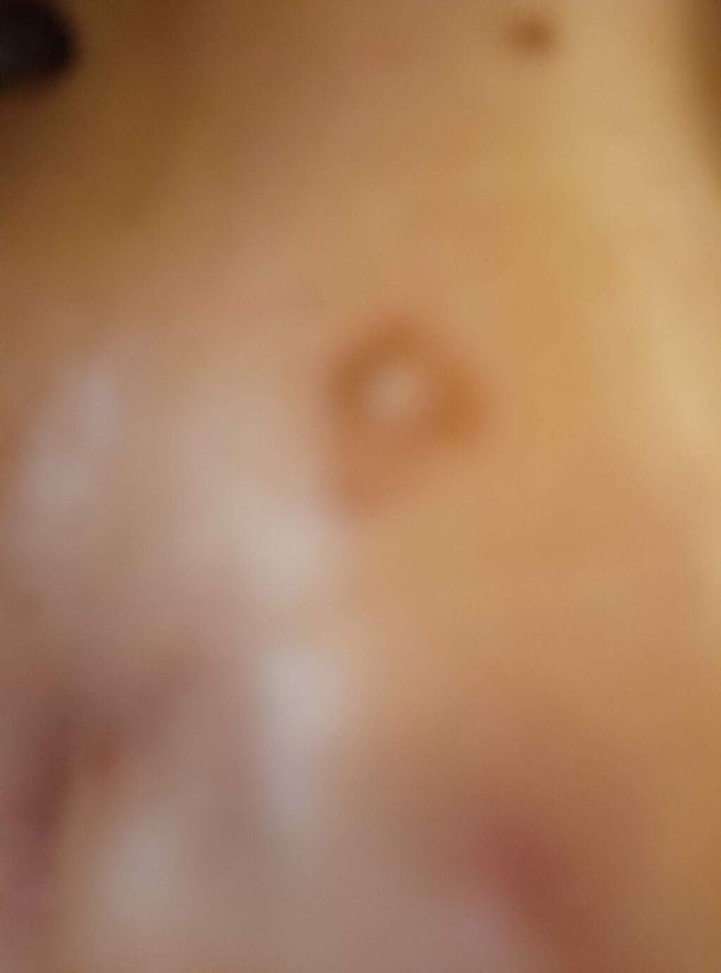 HINATA on LIPS 「鼻膿んだのかな…?どうしたら直りますか???敏感肌、アトピー持..」(1枚目)