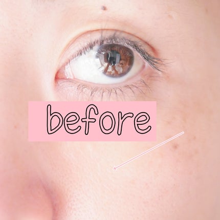 毛穴アンプル/ブラン/美容液を使ったクチコミ(6枚目)