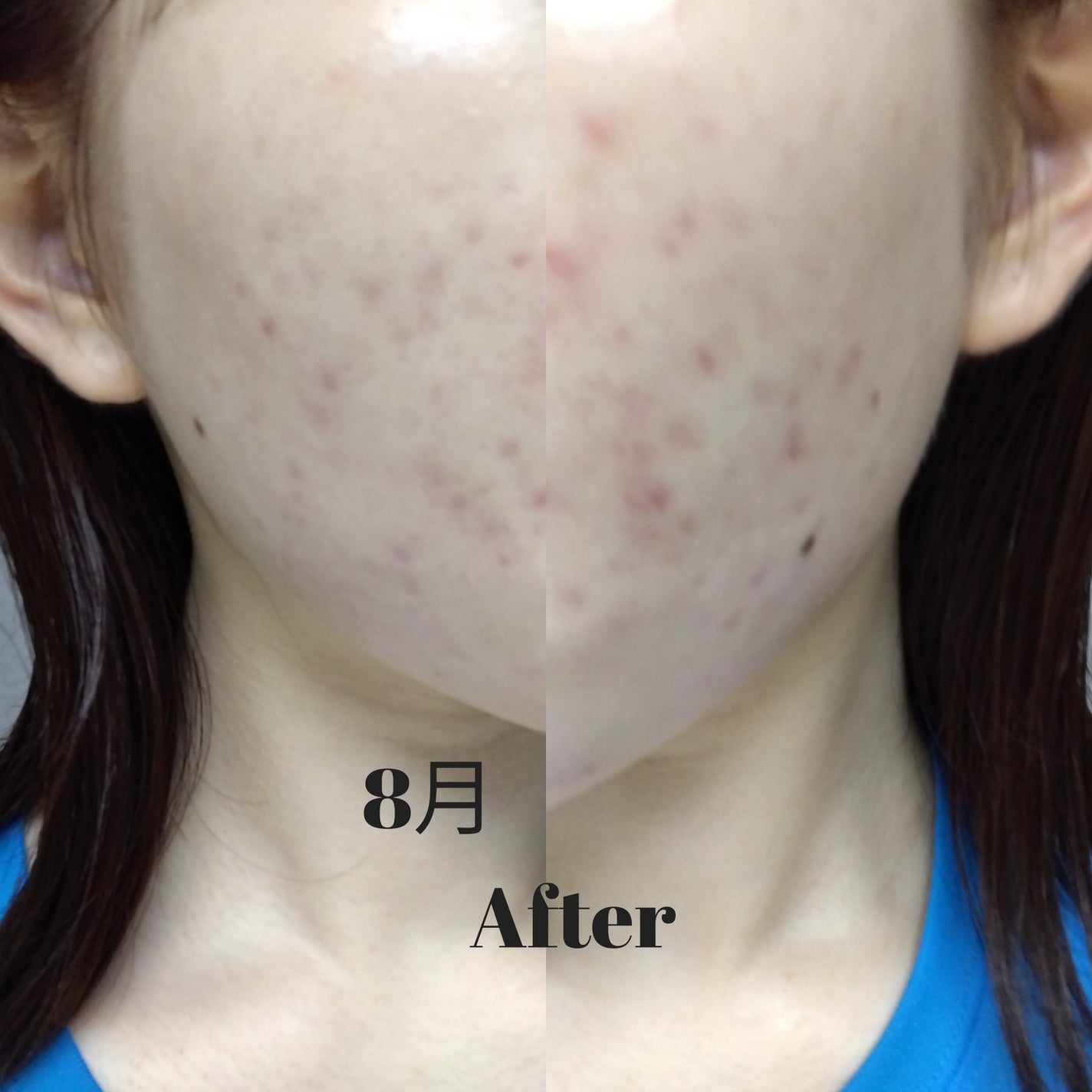 薬用 極潤 スキンコンディショナー/肌ラボ/化粧水を使ったクチコミ(4枚目)