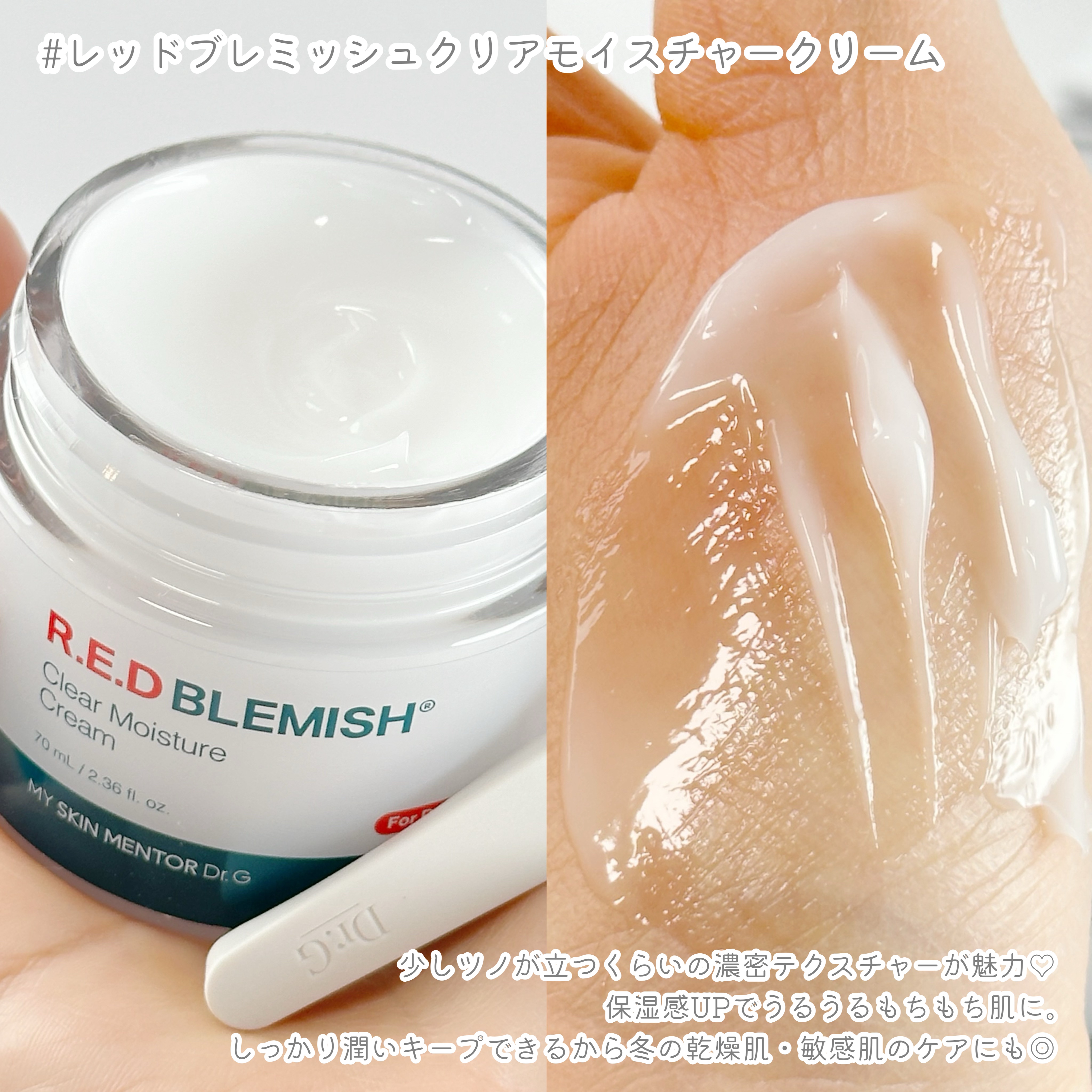 レッドブレミッシュ クリアモイスチャークリーム/Dr.G/フェイスクリームを使ったクチコミ（3枚目）