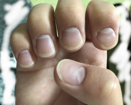 ネイルベッドオイル/アンドネイル/ネイルオイル・トリートメントを使ったクチコミ(2枚目)