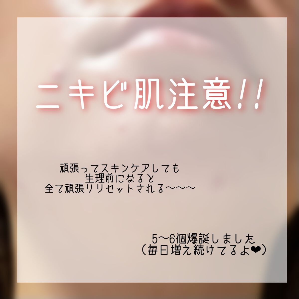 ツボクサ化粧水/ONE THING/化粧水を使ったクチコミ（1枚目）