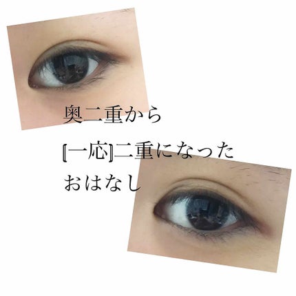 絆創膏/DAISO/その他を使ったクチコミ(1枚目)