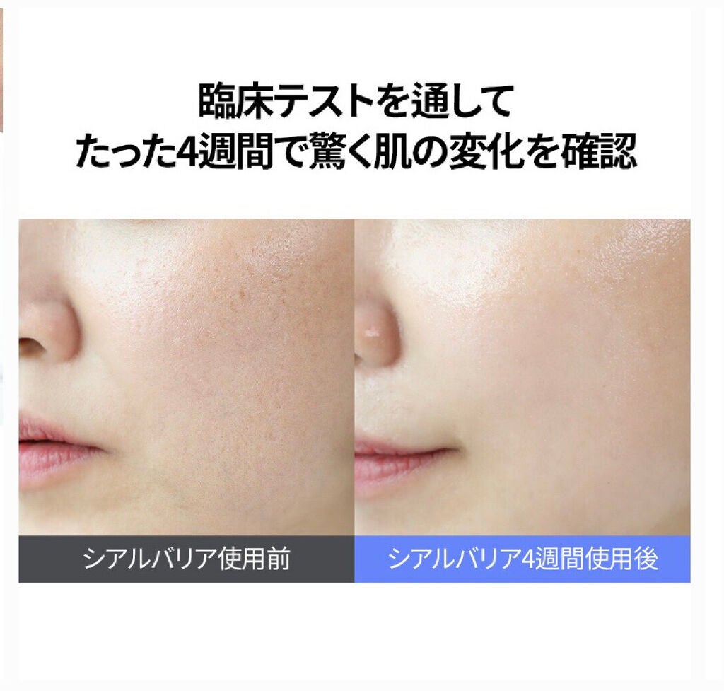 アクアインダーム スーパーエッセンス/ドクターシーラボⓇ/ブースター・導入液を使ったクチコミ(7枚目)