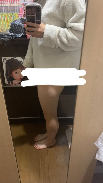 寝ながらメディキュット スパッツ 骨盤テーピング/メディキュット/着圧ソックス・レギンスを使ったクチコミ(2枚目)