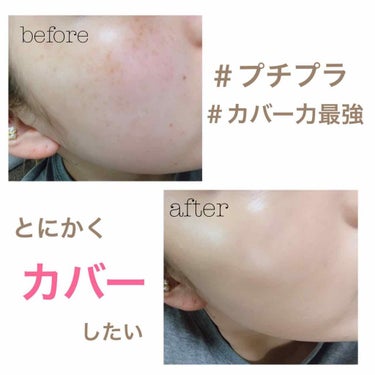 カバーパーフェクション チップコンシーラー/the SAEM/リキッドコンシーラーを使ったクチコミ（1枚目）