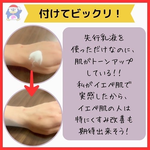 ジェネコス モイスト プレ ミルク 200mL/GENECOS/乳液を使ったクチコミ(8枚目)