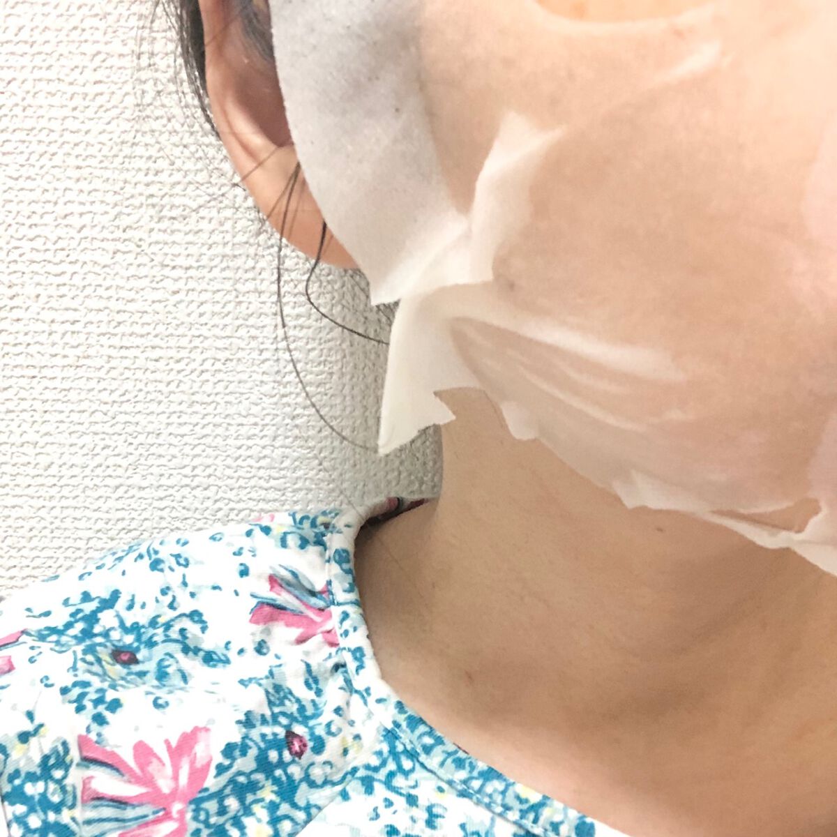 スキントラブルケア マスク/アルージェ/シートマスク・パックを使ったクチコミ（2枚目）