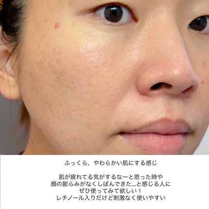 ピュア ナチュラル プレミアム リフティング クリームエッセンス【医薬部外品】/pdc/フェイスクリームを使ったクチコミ(8枚目)