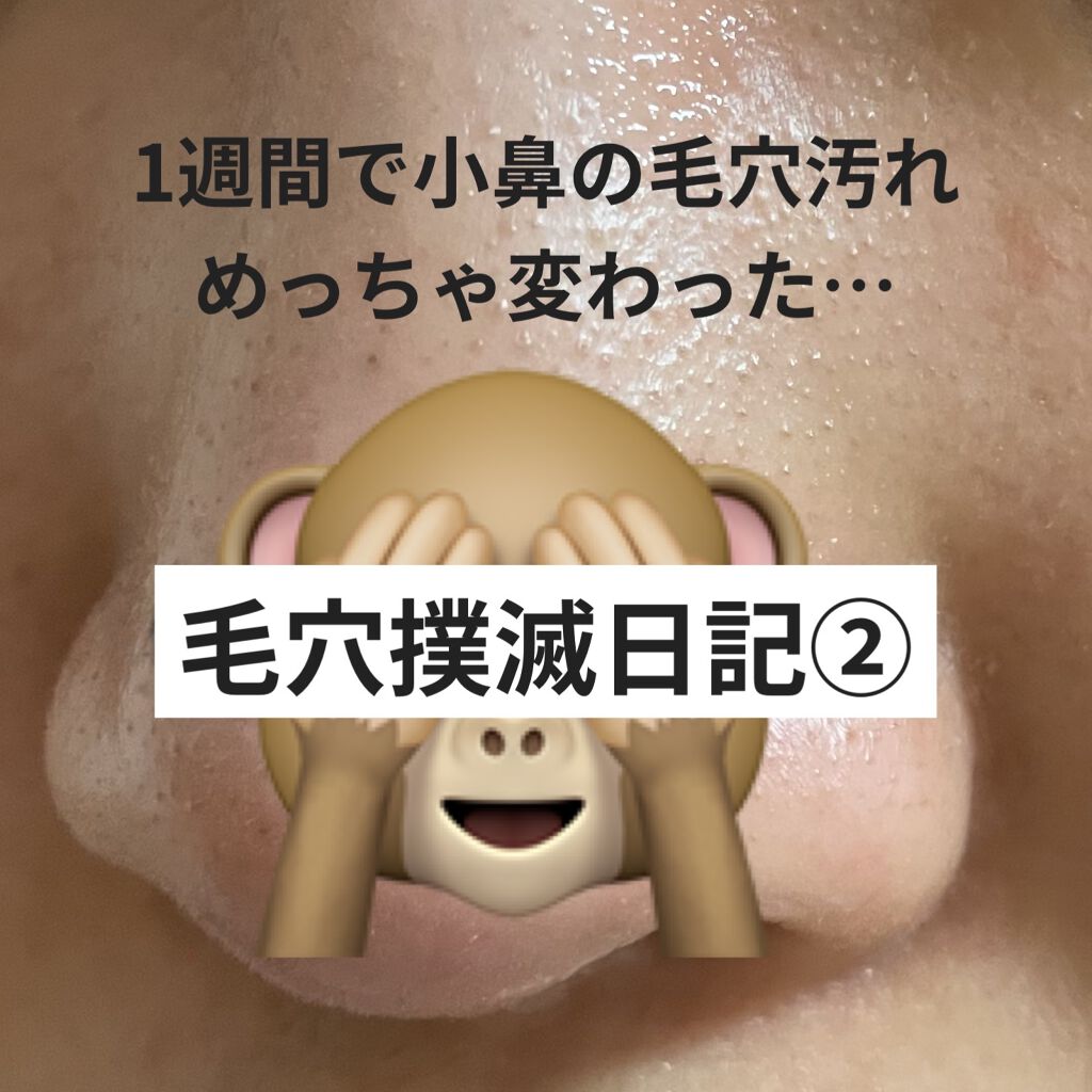 ウオーター/アベンヌ/ミスト状化粧水を使ったクチコミ（1枚目）