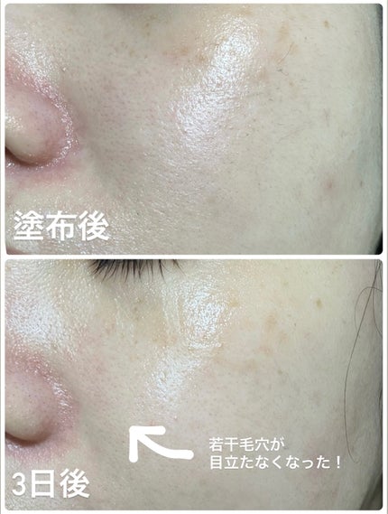 リードルショット300/VT/美容液を使ったクチコミ(3枚目)