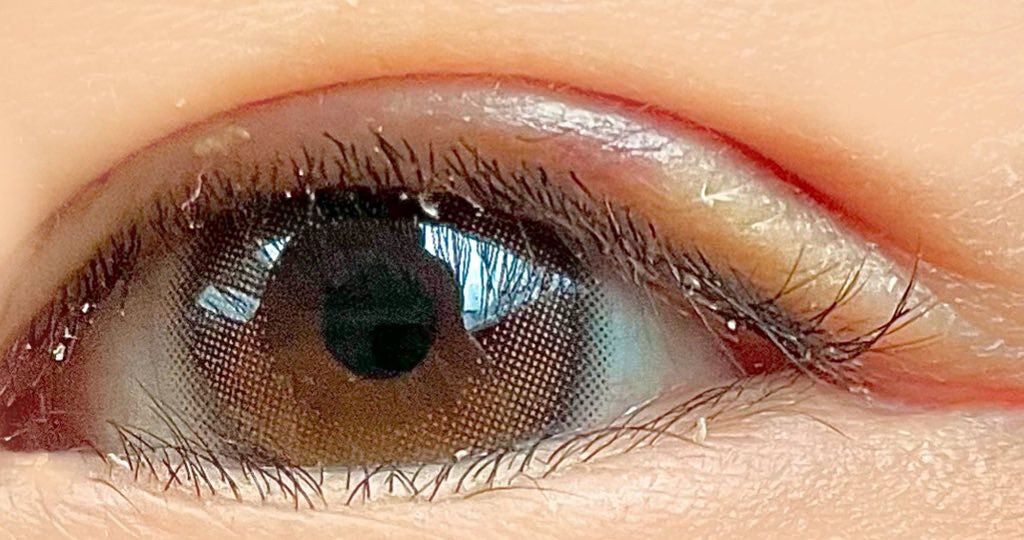 maringo22222 on LIPS 「昨日載せ忘れてた!ダウンタイム6日?もう腫れてないけどまだ内出..」(1枚目)