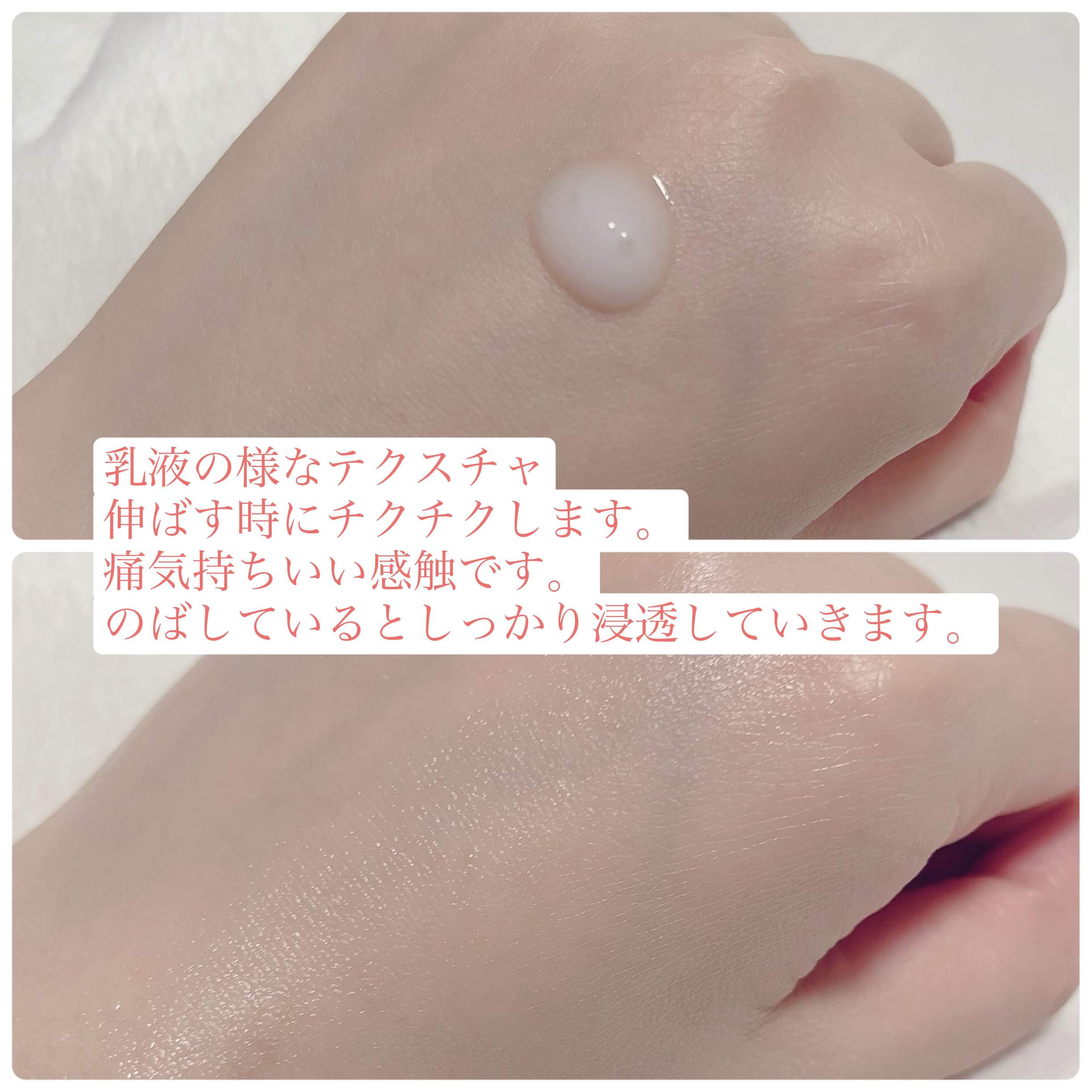 リードルショット100/VT/美容液を使ったクチコミ（2枚目）