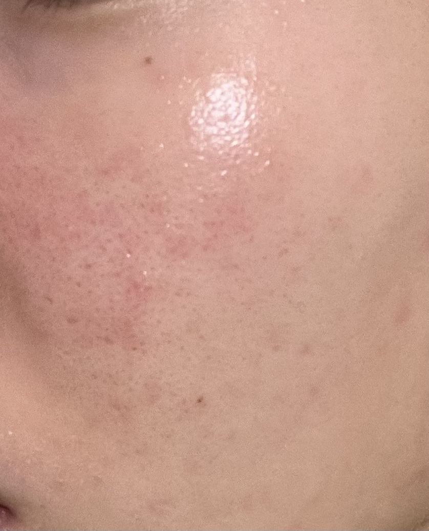 シカバイタル エッセンス/VT/美容液を使ったクチコミ（2枚目）