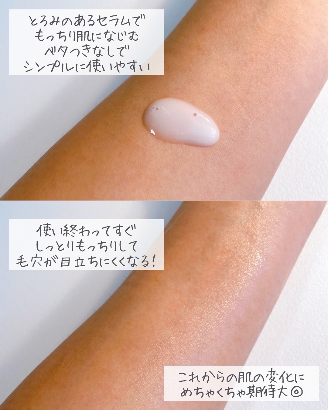 PHセンシティブマスクスージング＆モイスト/SAM'U/シートマスク・パックを使ったクチコミ（2枚目）