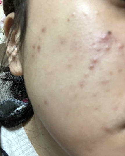 を使ったクチコミ(1枚目)