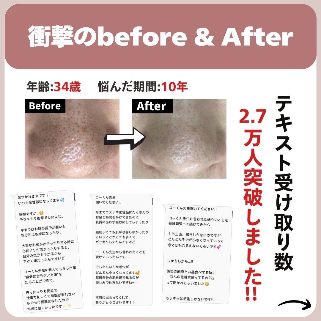 あなたの肌に合ったスキンケア💐コーくん先生 on LIPS 「【1割しか知らない】鼻の黒ずみを3日で消す裏技🤫..あなたの毛..」(8枚目)