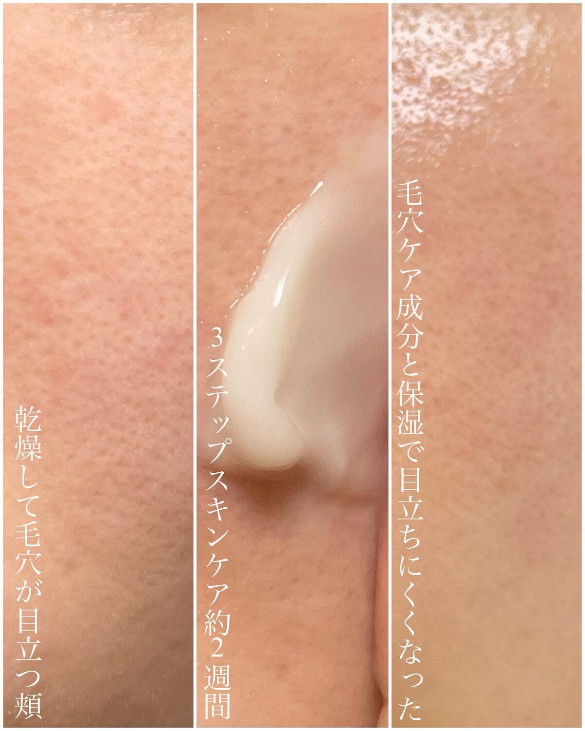 ピュアファジートナーRX/La dolf/化粧水を使ったクチコミ（2枚目）