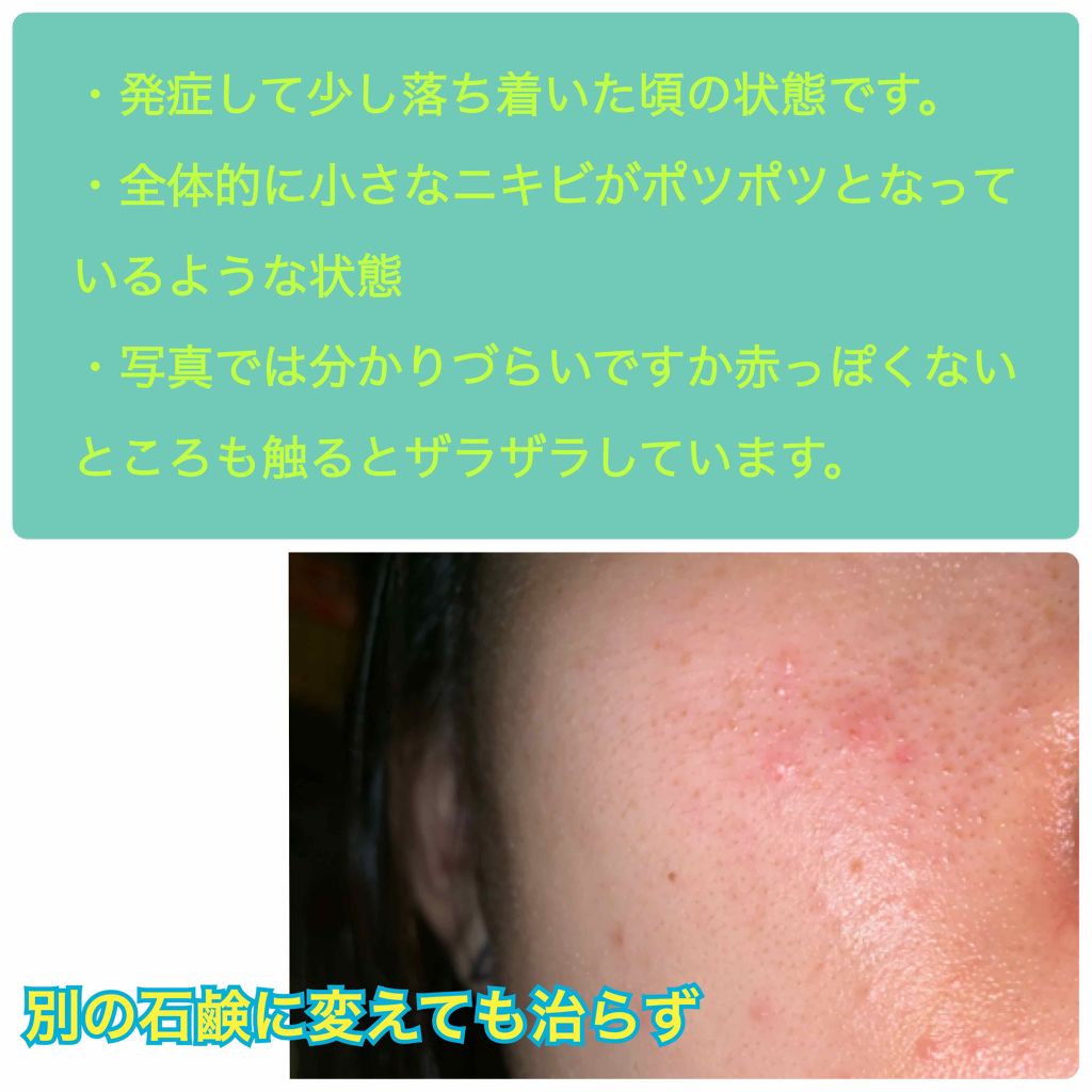 ヴォルカニックポア スクラブフォーム/innisfree/洗顔フォームを使ったクチコミ(3枚目)