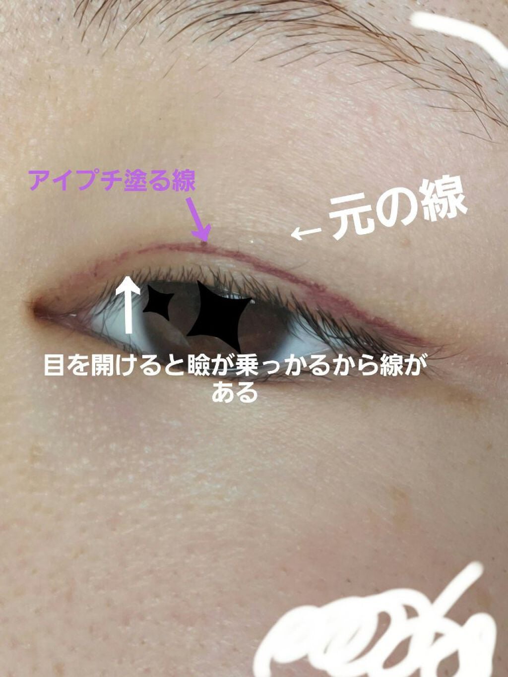 アイビューティー フィクサー WP/アストレア ヴィルゴ/二重まぶた用アイテムを使ったクチコミ(3枚目)