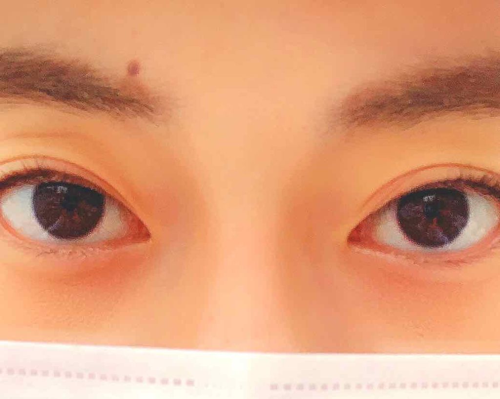 ワンダーアイリッドテープ Extra/D-UP/二重まぶた用アイテムを使ったクチコミ（1枚目）