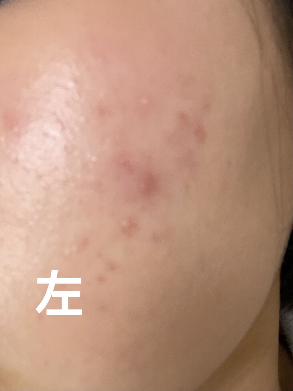 ハイジドルフジェル アロエ/ハイジドルフ/ボディローションを使ったクチコミ（1枚目）