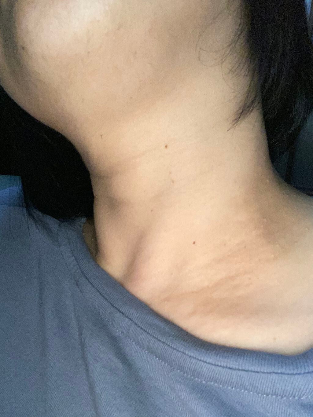 ハンデコルテ/キユートピア/ネック・デコルテケアを使ったクチコミ(5枚目)