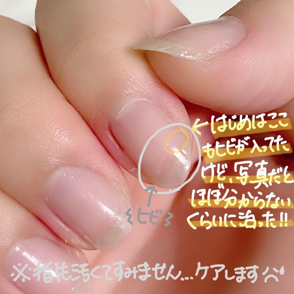 ネイルエンビー/O・P・I/ネイルオイル・トリートメントを使ったクチコミ(3枚目)