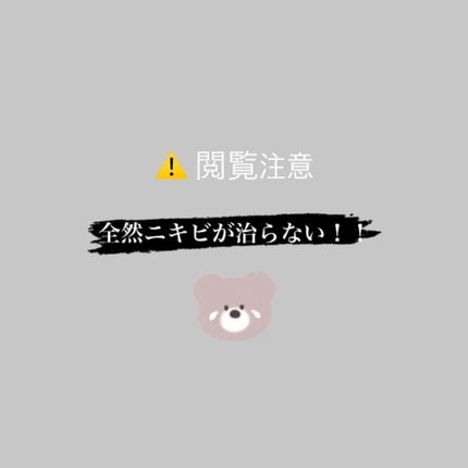 明色美顔水 薬用化粧水/美顔/化粧水を使ったクチコミ(1枚目)