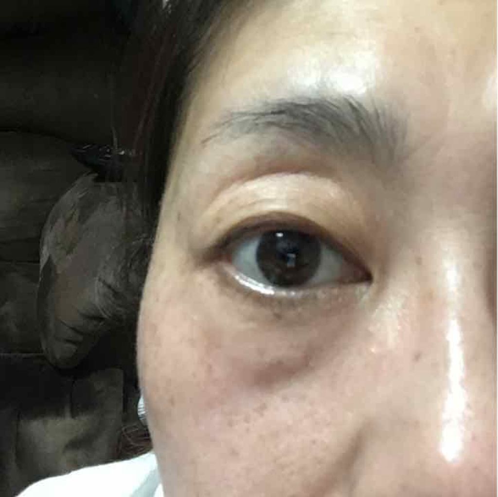 メラノショット ホワイト/ONE BY KOSE/美容液を使ったクチコミ（1枚目）